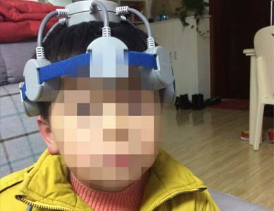 家用版经颅磁费用