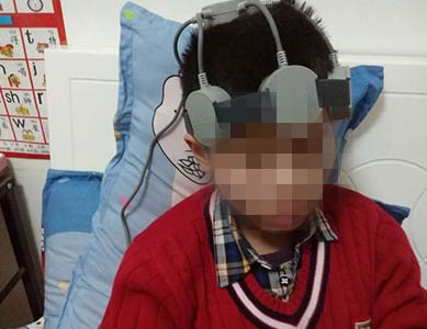 多动症和抽动症有关系吗